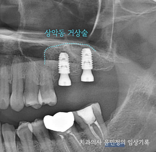 Treatment case image 5