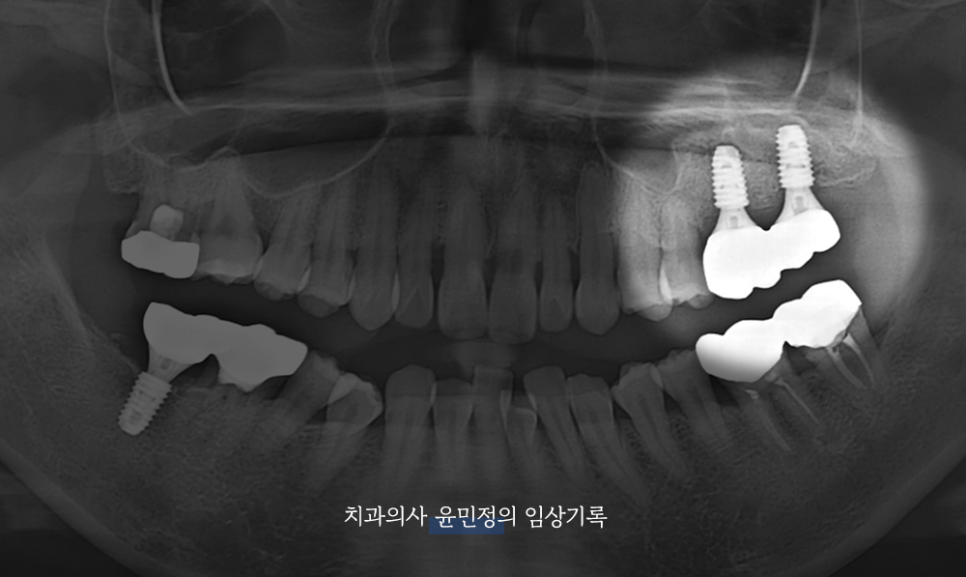 Treatment case image 7