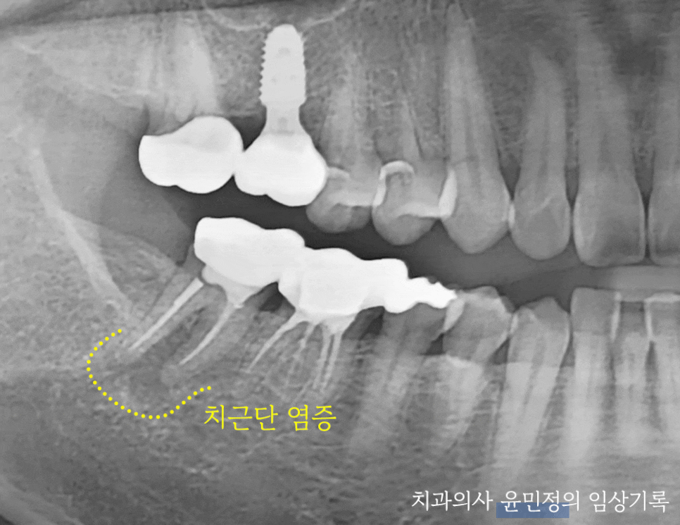 Treatment case image 1