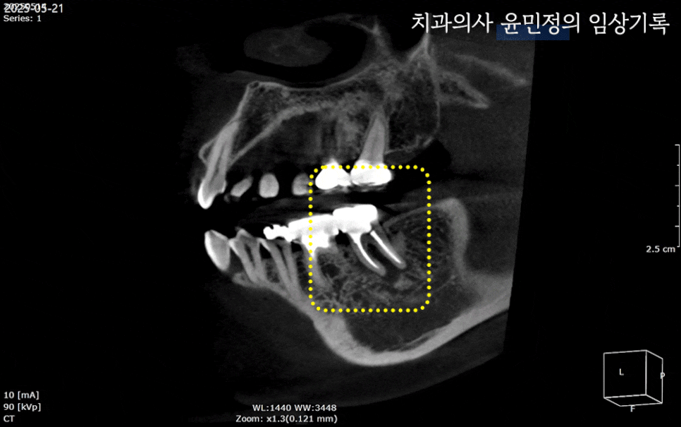 Treatment case image 2