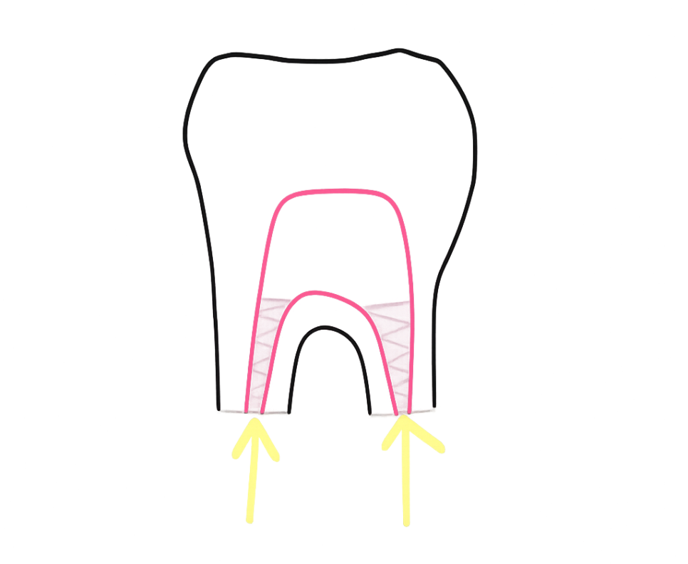 Treatment case image 5