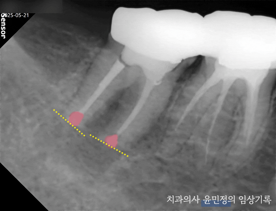 Treatment case image 6