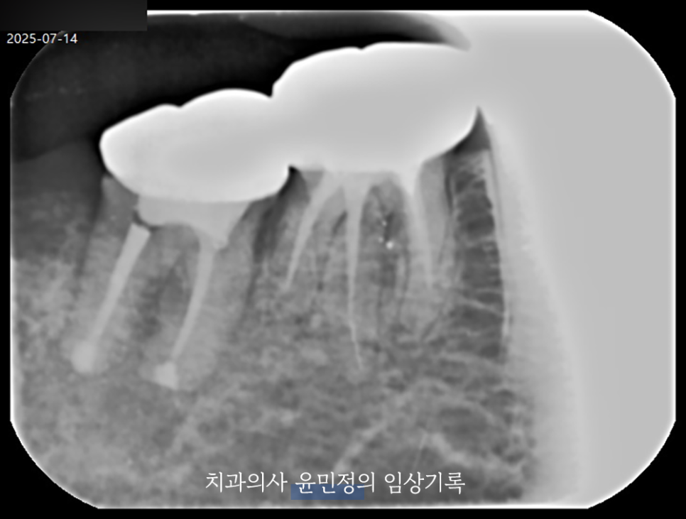 Treatment case image 7