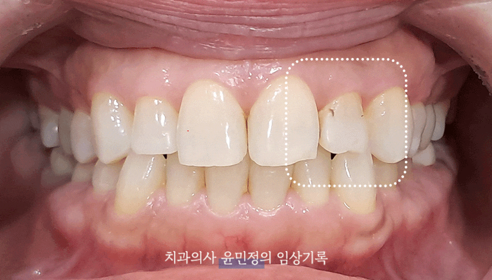 Treatment case image 1