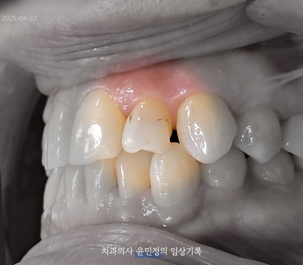 Treatment case image 3