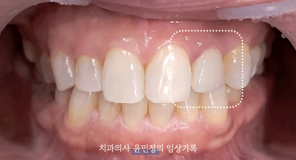 Treatment case image 7