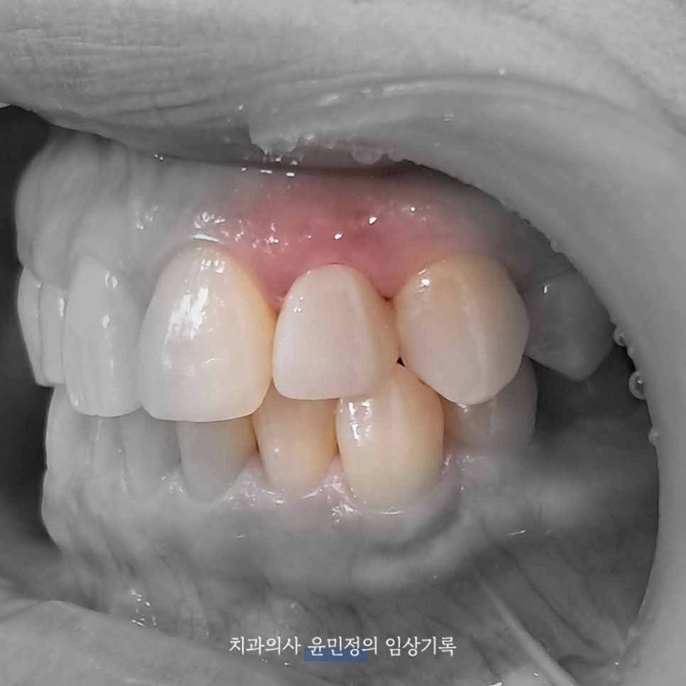 Treatment case image 8