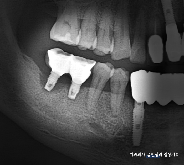 Treatment case image 1