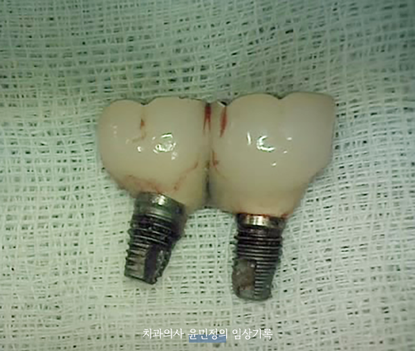 Treatment case image 3