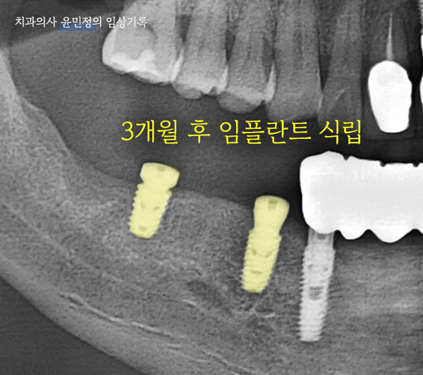 Treatment case image 4