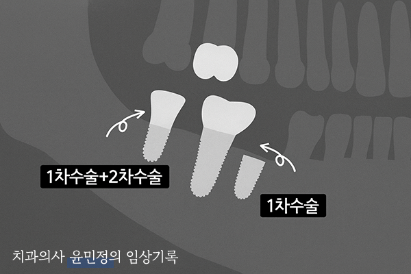 Treatment case image 5