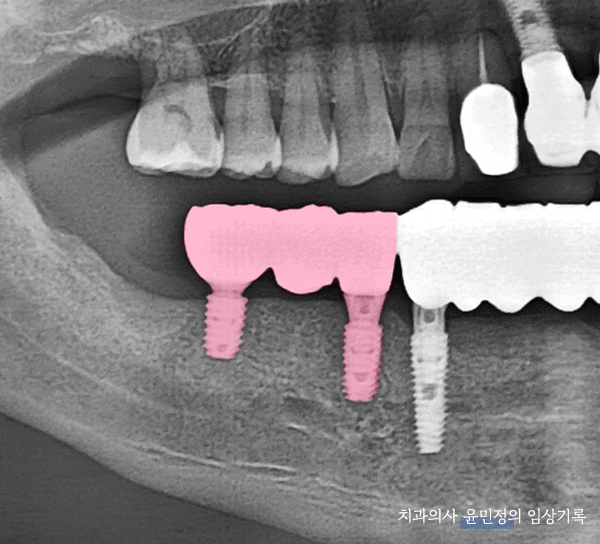 Treatment case image 6