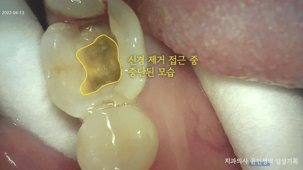Treatment case image 1