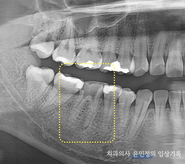 Treatment case image 2