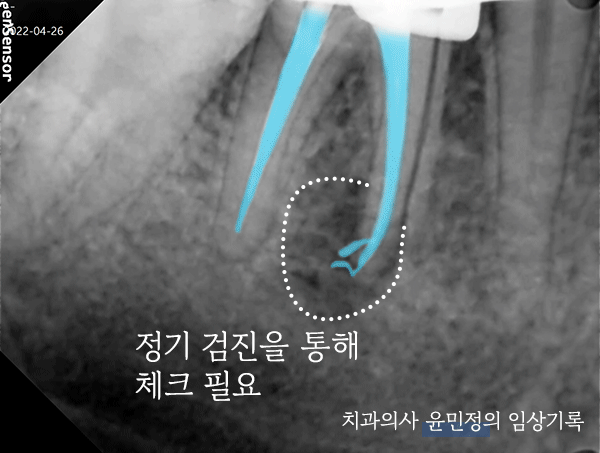 Treatment case image 4