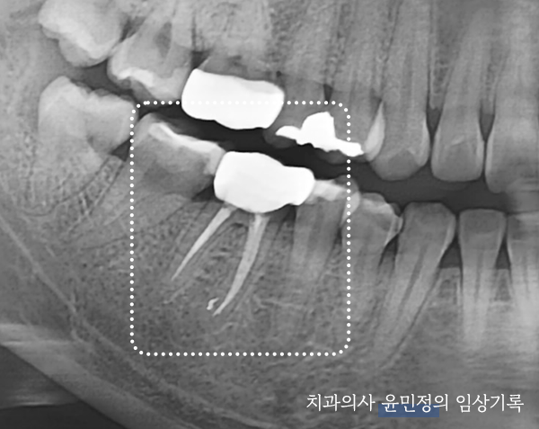 Treatment case image 5
