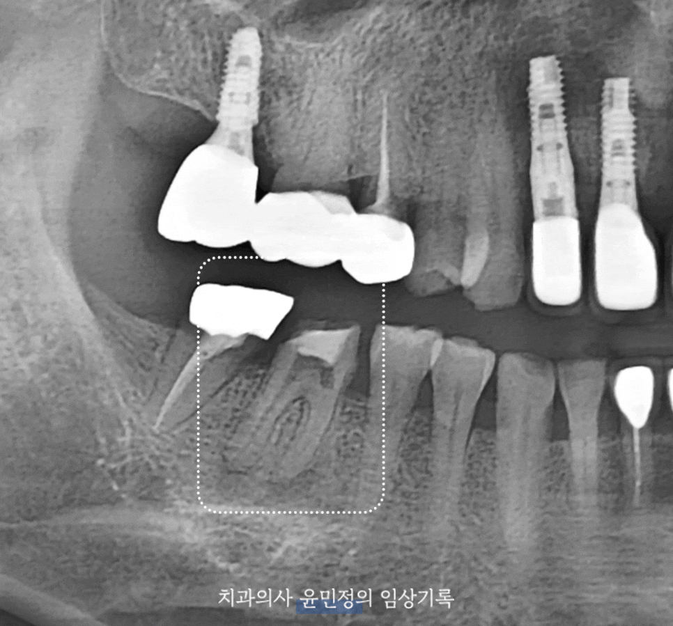 Treatment case image 1