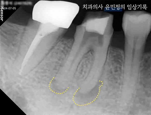 Treatment case image 3
