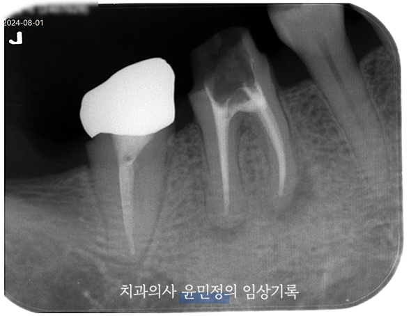 Treatment case image 6