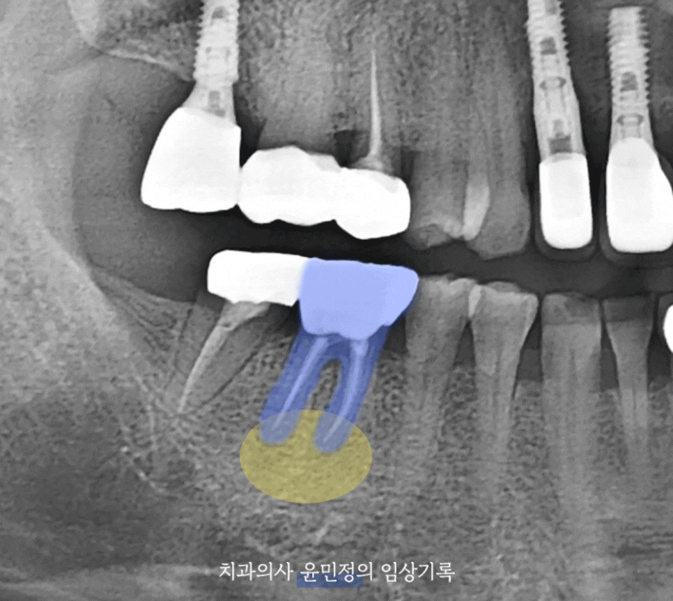 Treatment case image 7