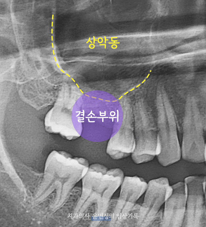 Treatment case image 1