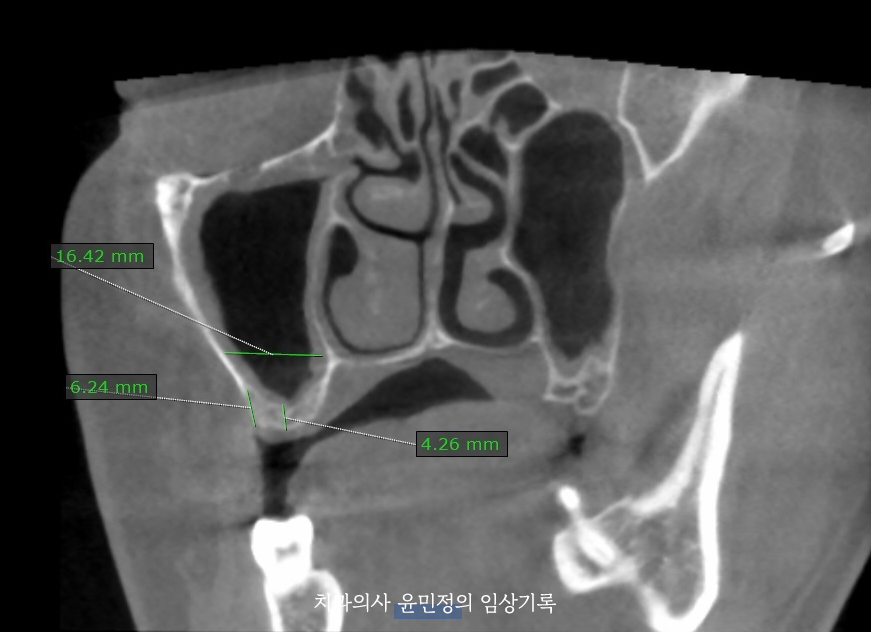 Treatment case image 2