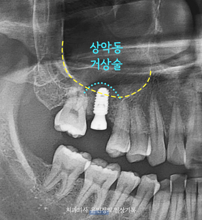 Treatment case image 5
