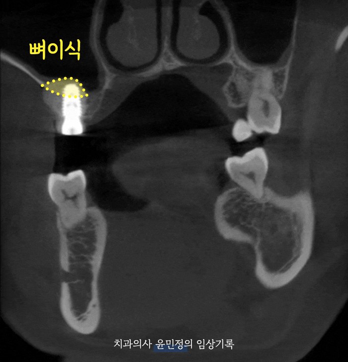 Treatment case image 6
