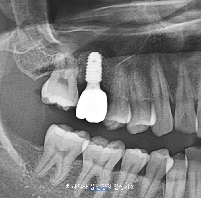 Treatment case image 9