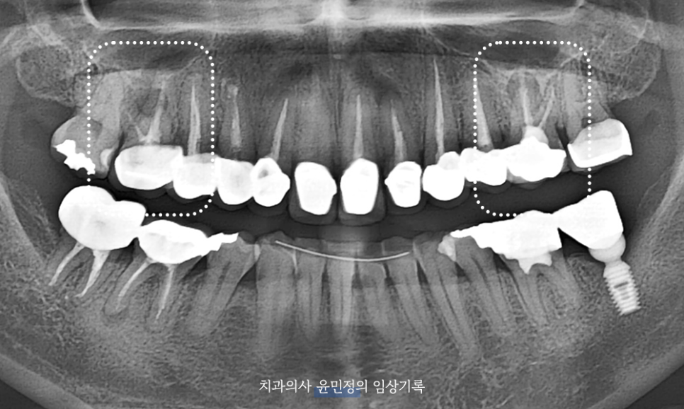 Treatment case image 1