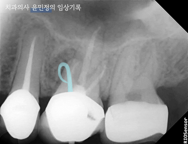 Treatment case image 3
