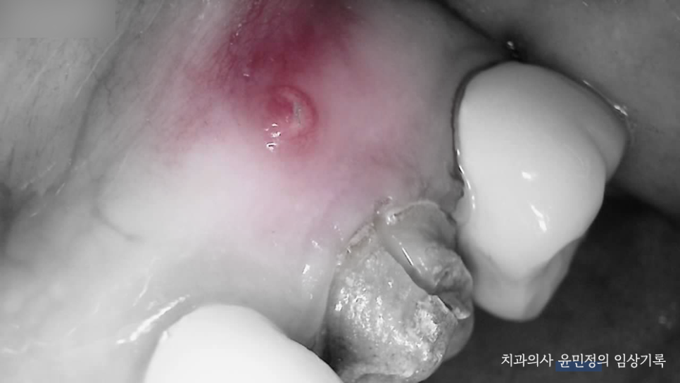 Treatment case image 4