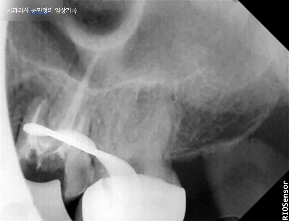 Treatment case image 5
