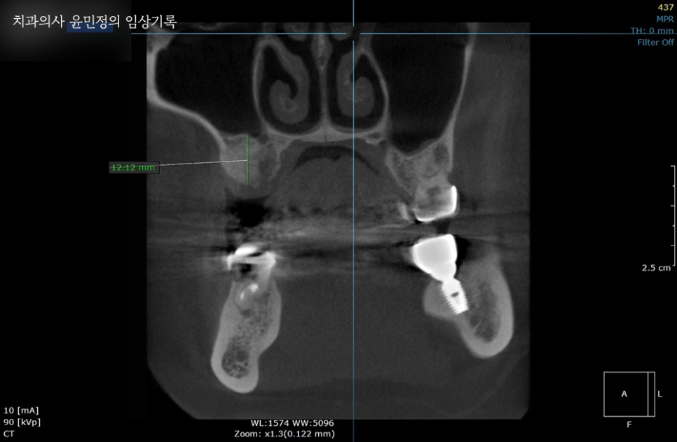 Treatment case image 6