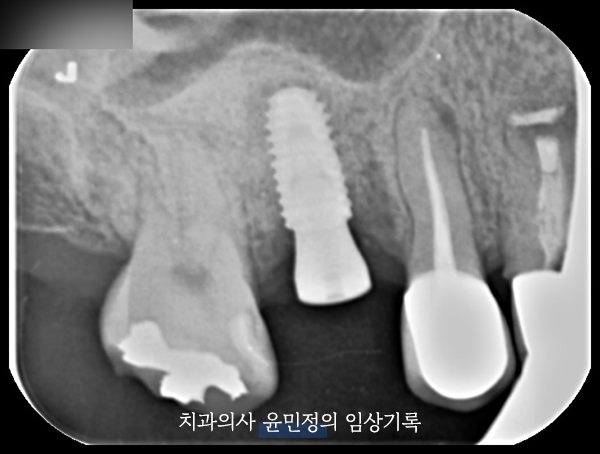 Treatment case image 7
