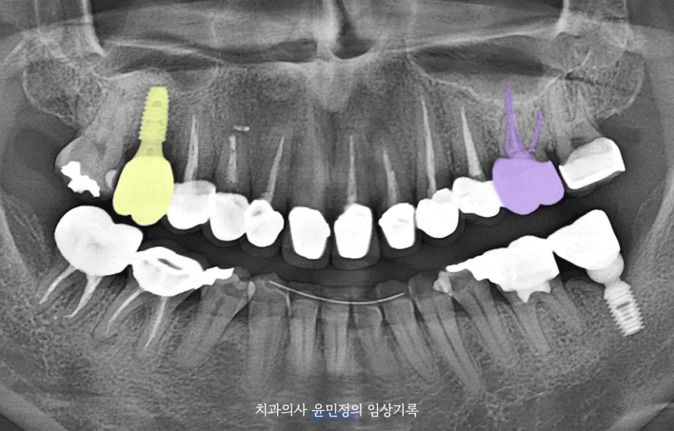 Treatment case image 10