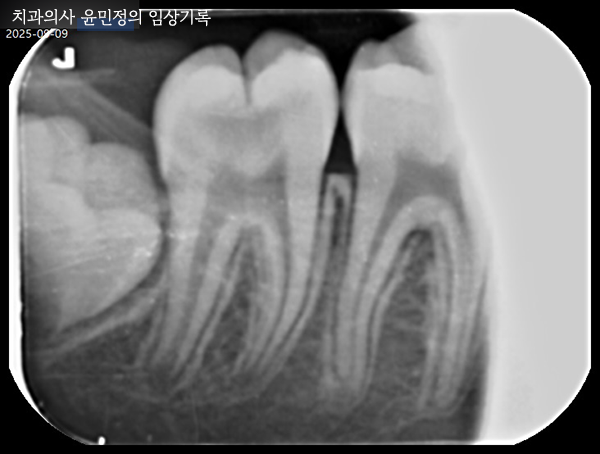 Treatment case image 1