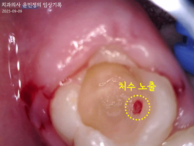 Treatment case image 3