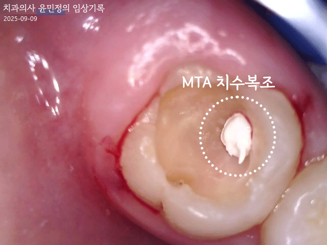 Treatment case image 4