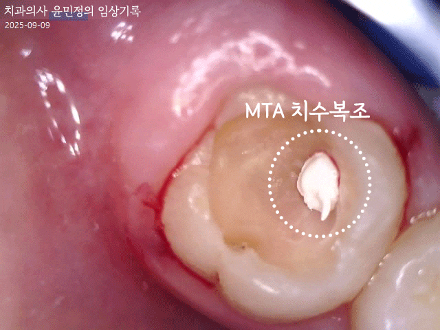 Treatment case image 3