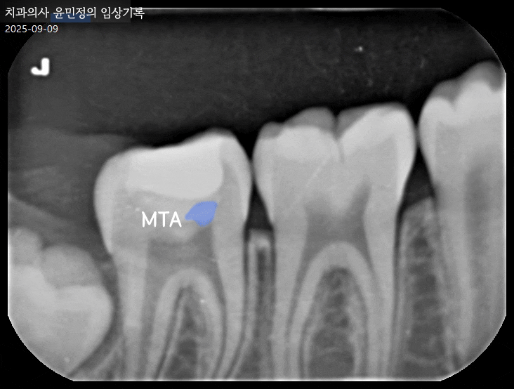 Treatment case image 8