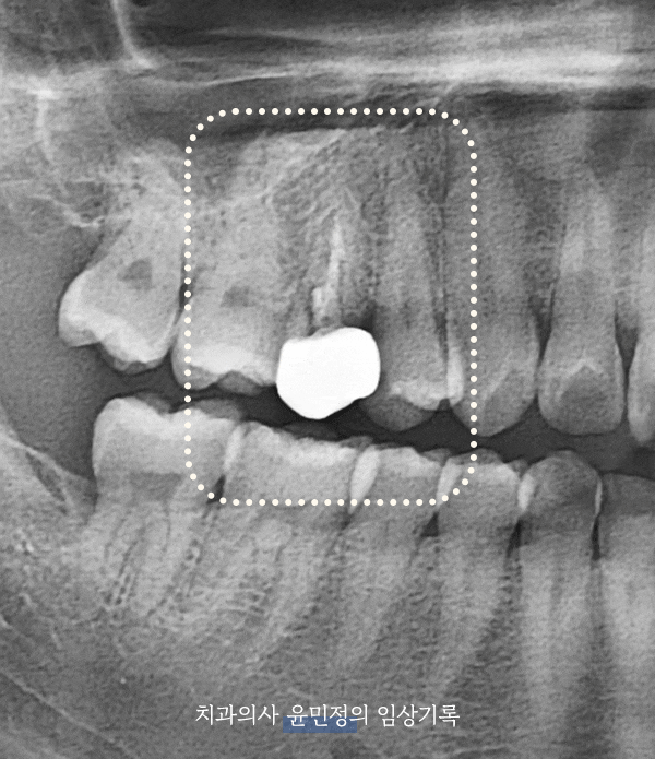 Treatment case image 1