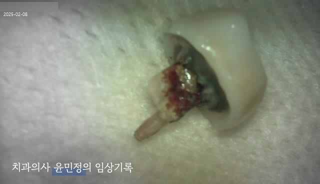 Treatment case image 3