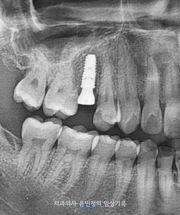 Treatment case image 4