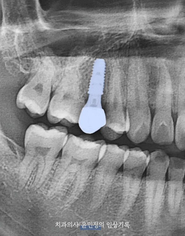 Treatment case image 6