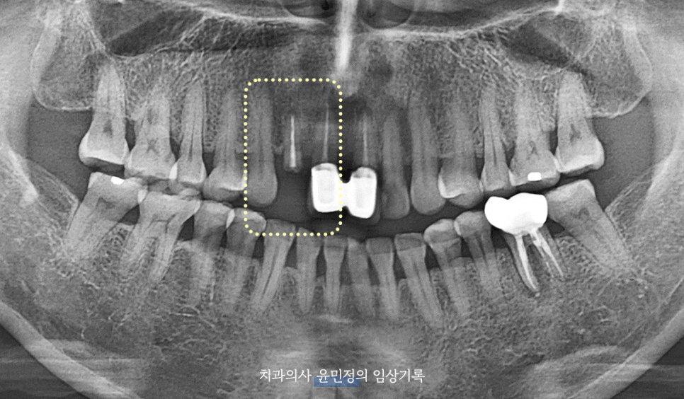 Treatment case image 1