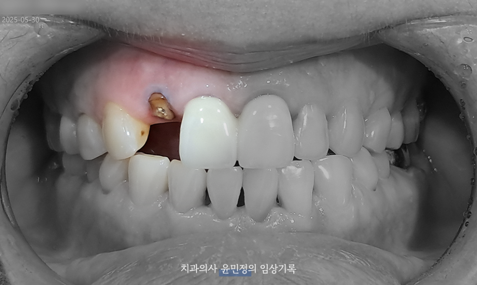 Treatment case image 2