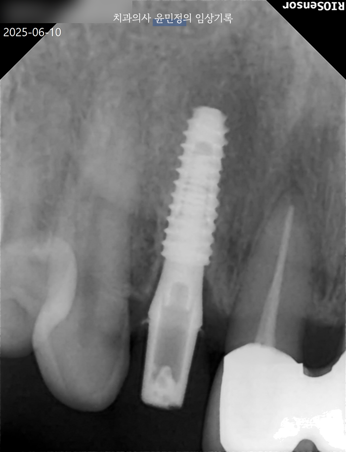 Treatment case image 3