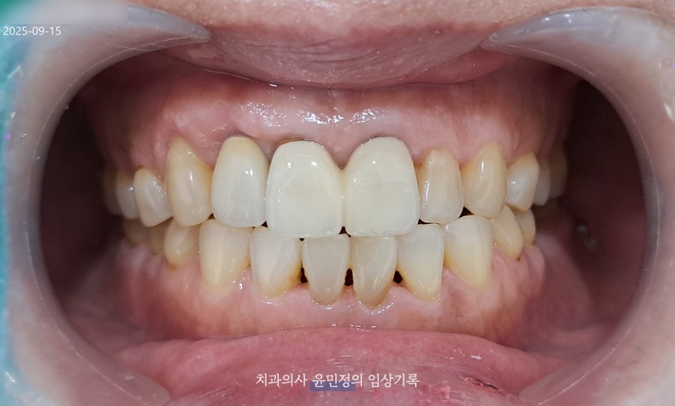 Treatment case image 4