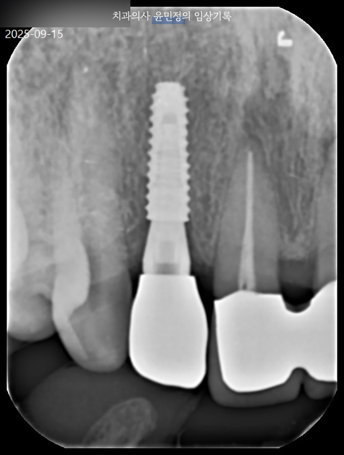 Treatment case image 5